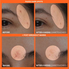 Vitamin C Green Tea Enzyme Brightening Serum Set